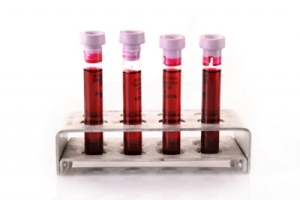 How to Read Your Liver Blood Test Results (Please read) - Part 1