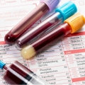 Blood results on EP Test Cyp, Mast E and Proviron