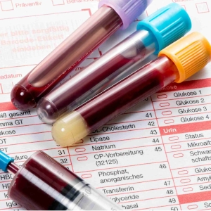Eurotropin bloodwork